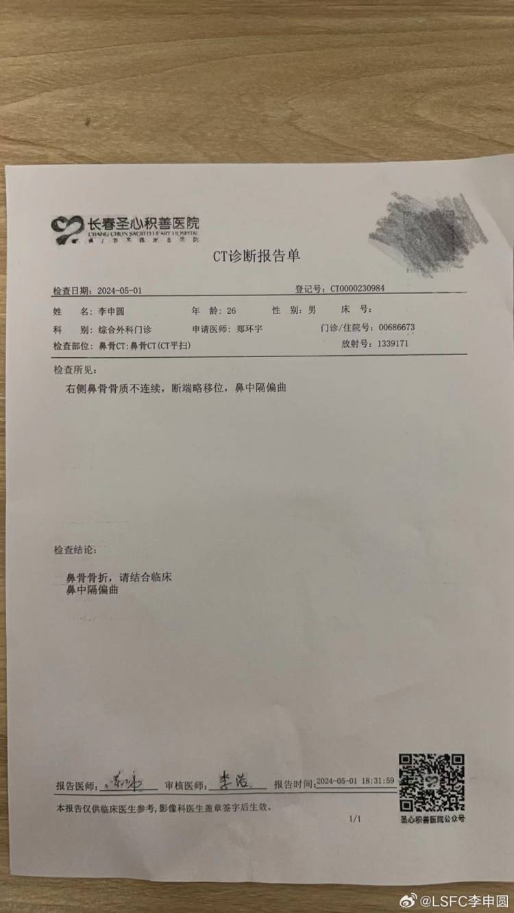 李申圆确诊鼻骨骨折，比赛中被蒂亚戈击中鼻子血流不止